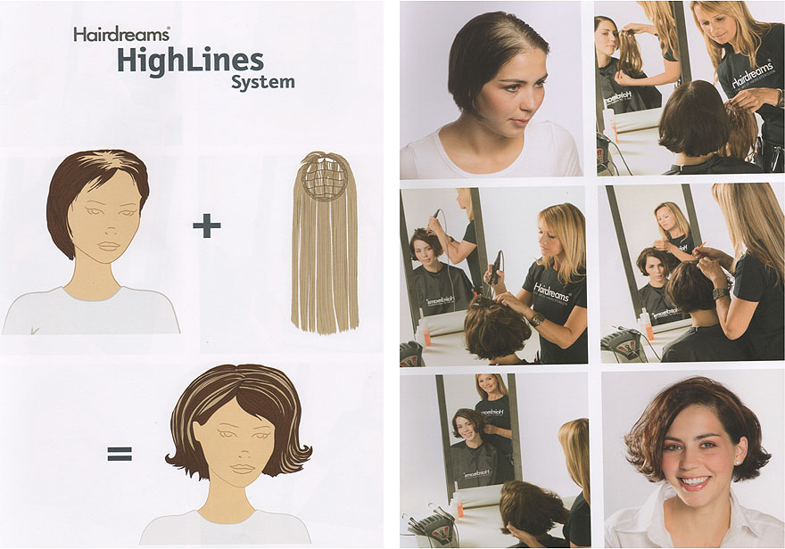 Haarverdichtung Hairdreams High Lines System