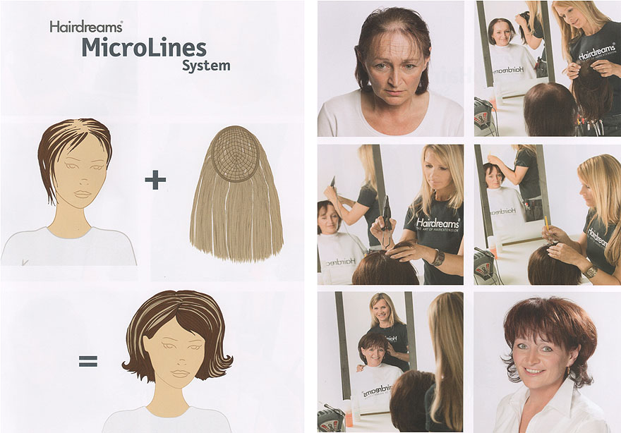 Haarverdichtung Hairdreams MicroLines System