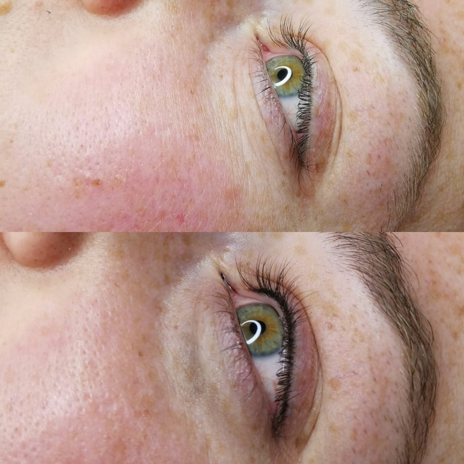 Wimpernkranzverdichtung permanent